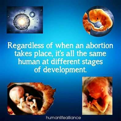stages of baby abortion